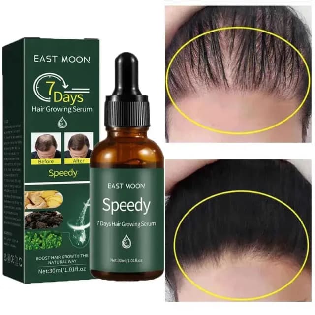 7 Days Anti Hair Loss Serum
