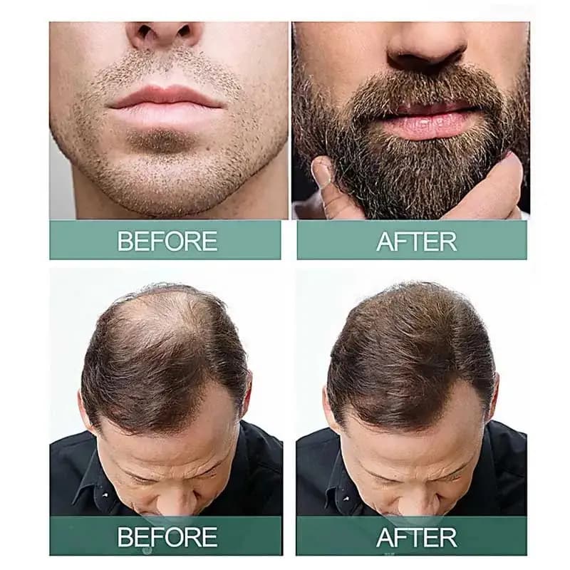 7 Days Anti Hair Loss Serum